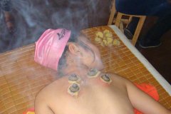 天天艾灸好吗?如何掌握艾灸的度?