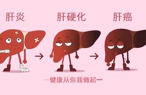 慢性肝炎