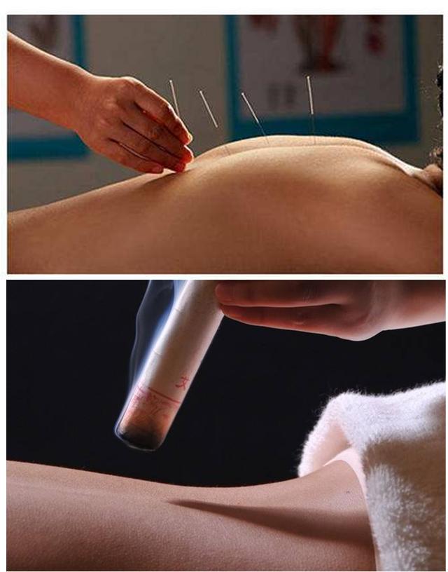 艾灸的作用和禁忌