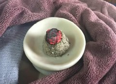 脐灸好处多,三大灸法五注意