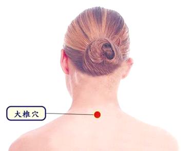 艾灸祛除雀斑省事又健康