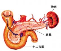 胰腺炎治疗:艾灸疗法治胰腺炎