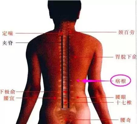 艾灸治疗子宫肌瘤