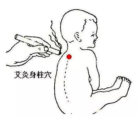 艾灸身柱穴