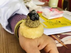 不好意思,艾灸并没你想得那么＂神＂!