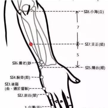 扁平疣怎么治
