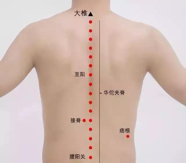 痞根