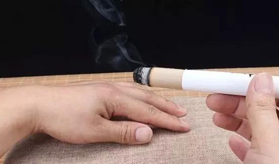 艾灸的禁忌