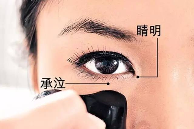 睛明穴