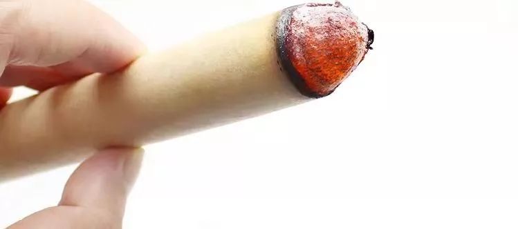 艾灸软化血管