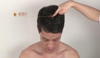 前顶穴