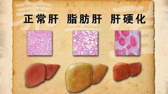 这几个穴才是艾灸养肝最重要的穴