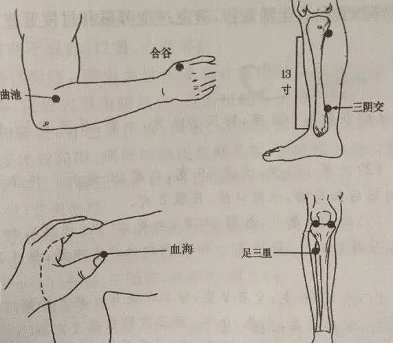 荨麻疹灸法