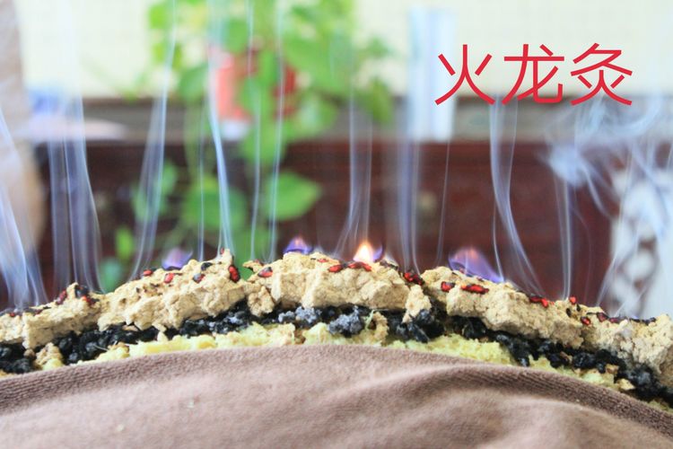 艾灸的好处