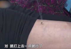 第三章第四节灸后调理与调养