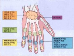 第三章常见病灸疗法与配穴:运动系统疾病