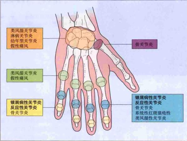 运动系统疾病