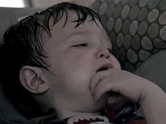 第三章常见病灸疗法与配穴:其他杂症