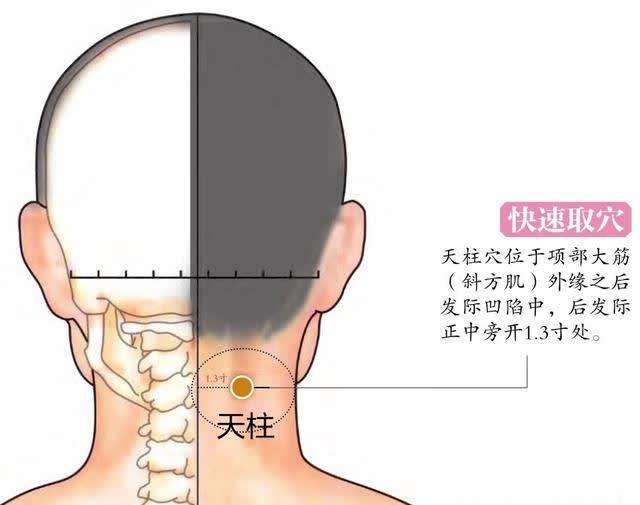 艾灸治疗颈椎病配穴