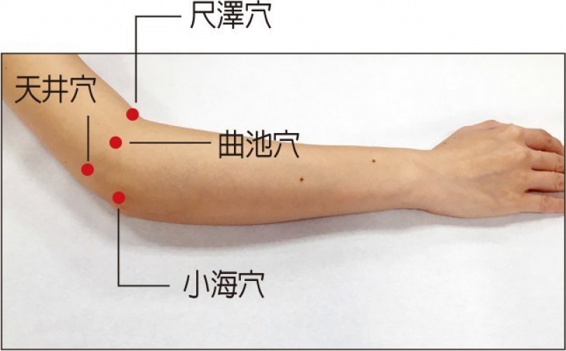 艾灸疗法对扭伤的治疗
