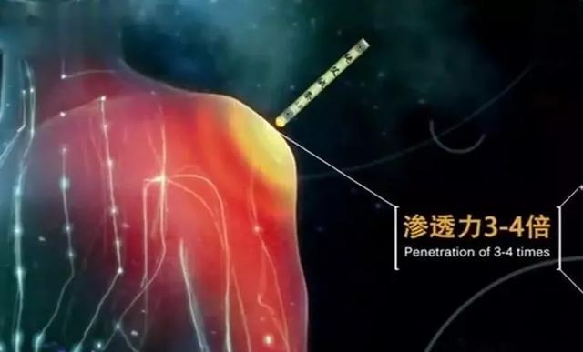 艾灸前要开穴,艾灸后要封穴!都知道吗?