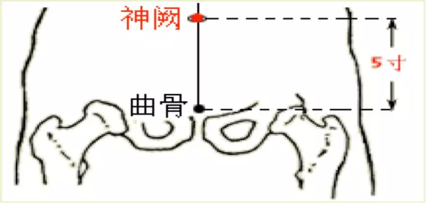 神阙