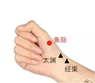 鱼际穴