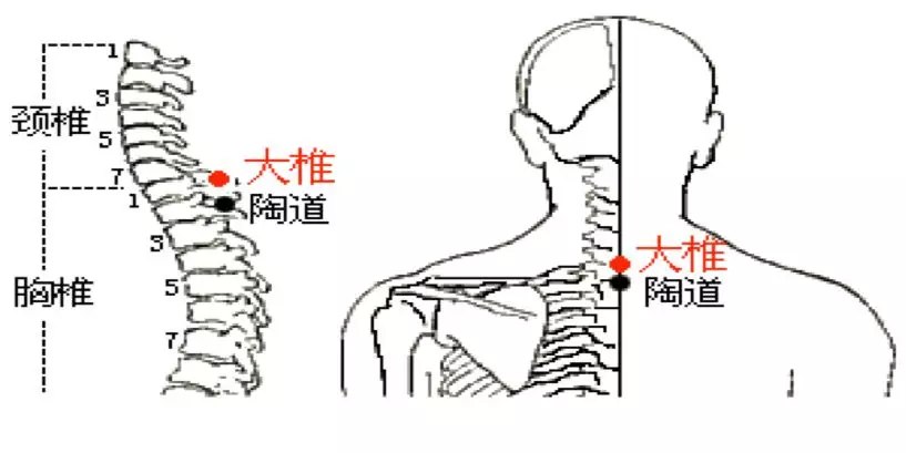 大椎