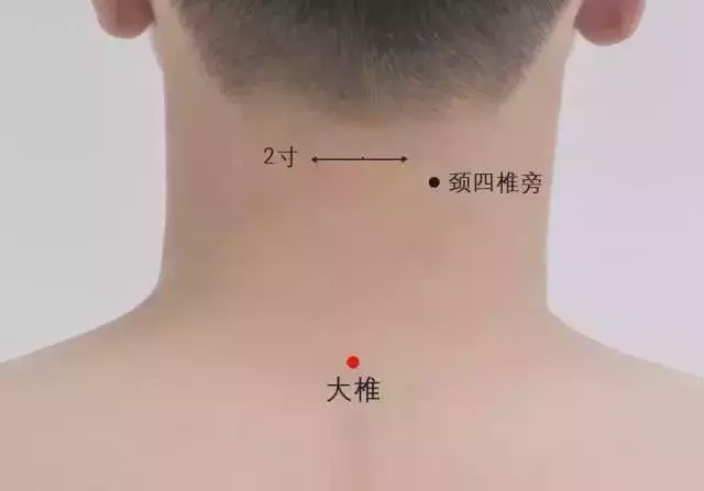 大椎穴