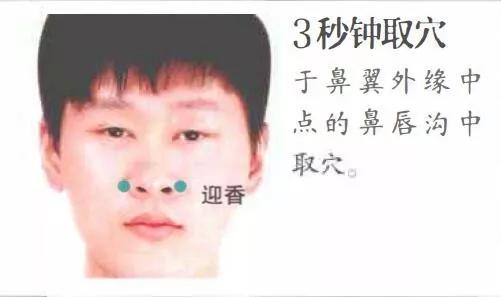 迎香穴