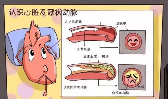 冠心病