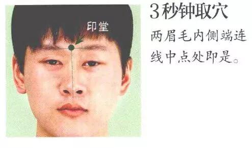 印堂穴