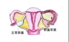 女性最怕的卵巢早衰,怎么缓解和调治