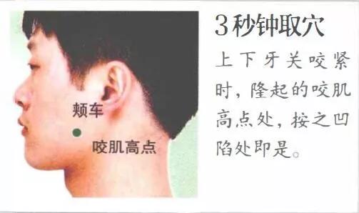 颊车穴