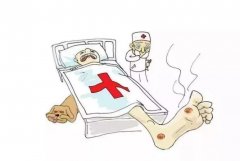 糖尿病足的艾灸调理法