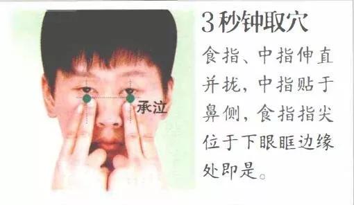 承泣穴