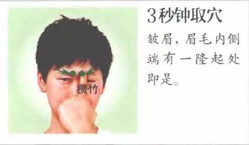 攒竹穴