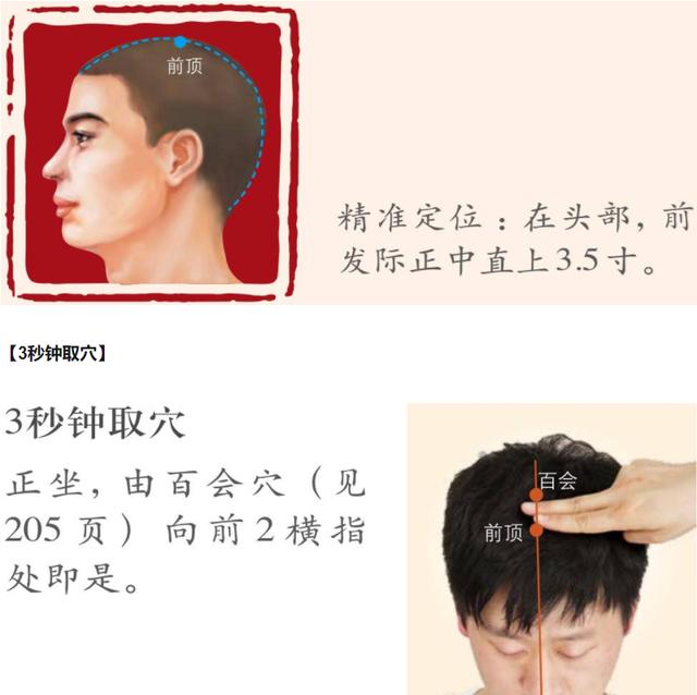 前顶穴