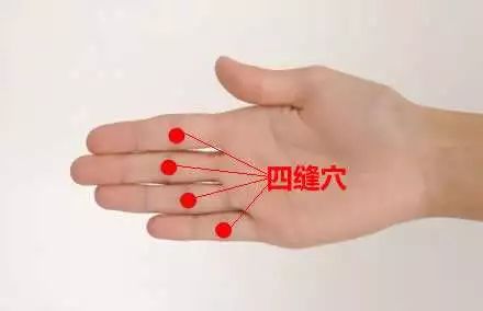 四缝穴
