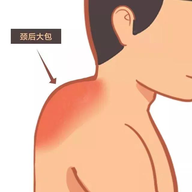 富贵包