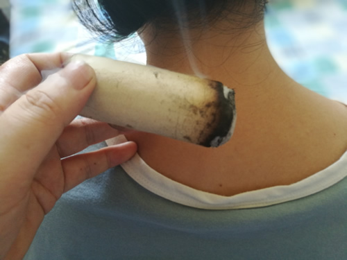 艾灸的好处
