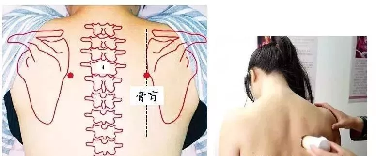 艾灸膏肓穴
