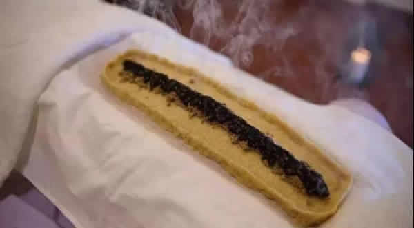 督脉灸