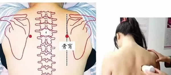 肓俞穴 