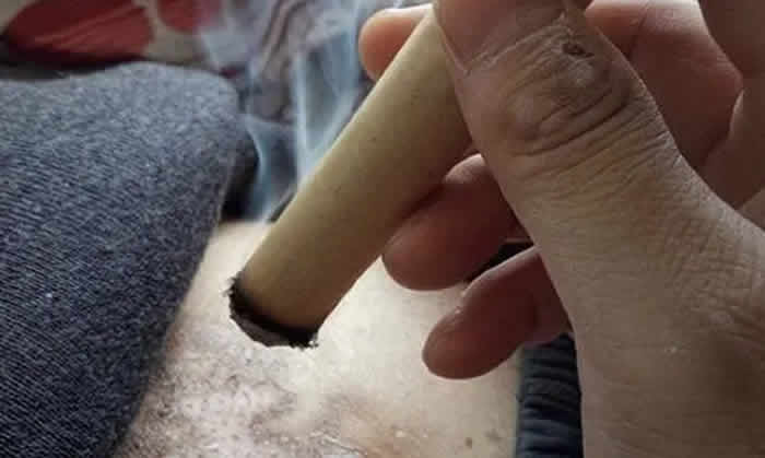 三伏一刻抵千金,三伏灸特别适合调理妇科病!