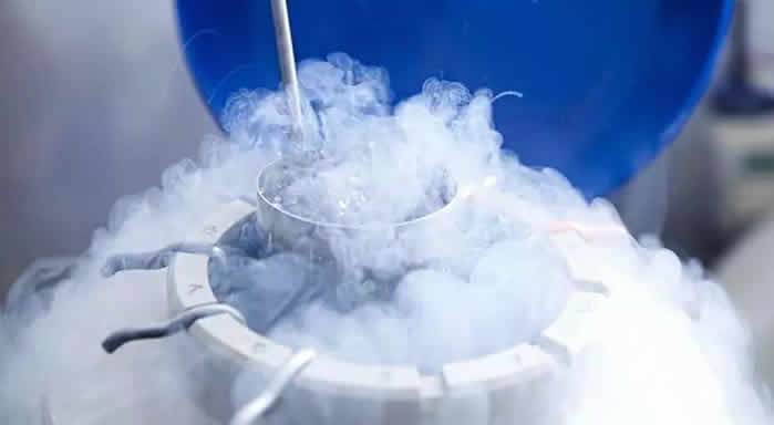 液氮灸