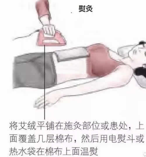 日灸和熨灸是非常好的艾灸方法