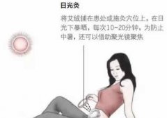 日灸和熨灸是非常好的艾灸方法