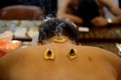 艾灸哪个位置排湿气?艾灸后湿气寒气去了哪