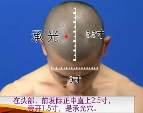 承光穴的准确穴位图及作用